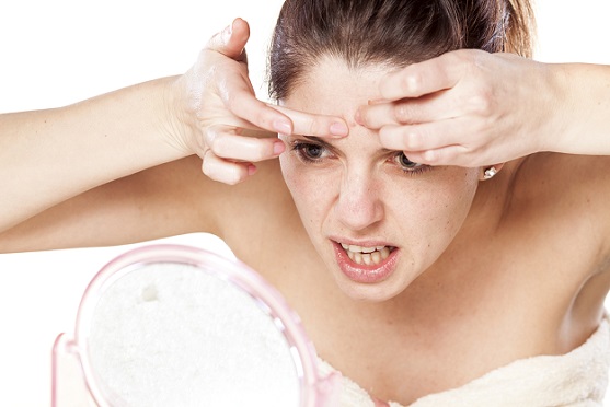 Does popping pimples worsen acne?